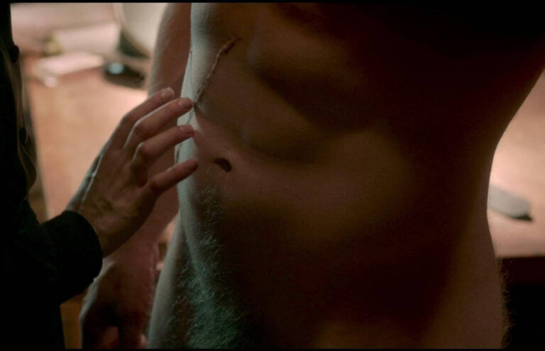 A hand touches a person's bare torso, which has a visible scar and wound near the ribs, capturing raw emotion and creativity often found in Gay Art.